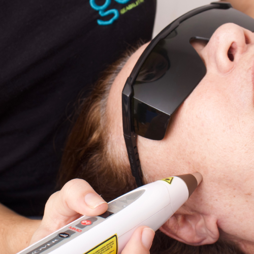 Aplicação de laser terapêutico na face para tratamento de paralisia facial na Gomo Reabilitação Neurofuncional